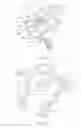 Fig. 17 - HEAD AND NECK RESTRAINT DEVICE WITH DYNAMIC ARTICULATION