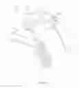 Fig. 33 - HEAD AND NECK RESTRAINT DEVICE WITH DYNAMIC ARTICULATION
