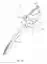 Fig. 35 - HEAD AND NECK RESTRAINT DEVICE WITH DYNAMIC ARTICULATION
