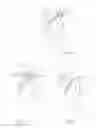 Fig. 38 - HEAD AND NECK RESTRAINT DEVICE WITH DYNAMIC ARTICULATION