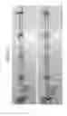 Fig. 10 - System and method for biomimetic fluid processing