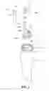 Fig. 03 - Liquid discharging vessel