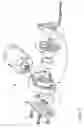 Fig. 10 - Handheld fluid sprayer