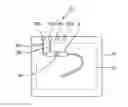 Fig. 01 - Method for operating a reconditioning apparatus and a medical system
