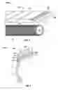Fig. 05 - Method of retreading a tire