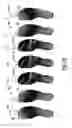Fig. 25 - Footwear plate