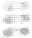Fig. 17 - Footwear with traction elements