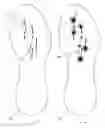 Fig. 22 - Footwear with traction elements