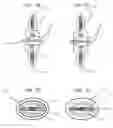 Fig. 16 - Three-way marker for sewing