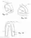 Fig. 15 - Collapsible wheels and methods of making collapsible wheels
