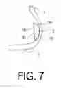 Fig. 08 - Pneumatic tire with removably mounted run-flat load support bodies