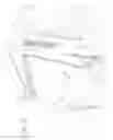 Fig. 12 - Zipper less removable windows for a folding suv soft top