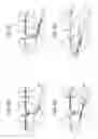 Fig. 07 - Folding device with skew correction