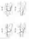 Fig. 11 - Folding device with skew correction