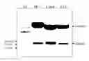 Fig. 01 - Method for preparing multimeric forms of the hepatitis c virus (HCV) envelope glycoprotein 2 (HCV E2)