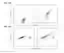 Fig. 12 - Antibodies capable of binding to the coagulation factor XIa and uses thereof