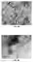 Fig. 06 - In-situ polymerization method for producing a polyethylene nanocomposite