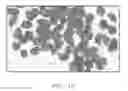 Fig. 11 - PARTICULATE MATERIAL AND METHOD FOR FORMING SAME