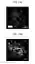Fig. 30 - Microfluidic chip, three-dimensional channel structure, cell culture method using same, and activity evaluation method of bioactive substance using same