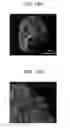 Fig. 31 - Microfluidic chip, three-dimensional channel structure, cell culture method using same, and activity evaluation method of bioactive substance using same