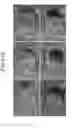 Fig. 34 - Microfluidic chip, three-dimensional channel structure, cell culture method using same, and activity evaluation method of bioactive substance using same