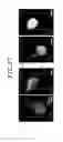 Fig. 40 - Microfluidic chip, three-dimensional channel structure, cell culture method using same, and activity evaluation method of bioactive substance using same