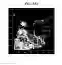 Fig. 45 - Microfluidic chip, three-dimensional channel structure, cell culture method using same, and activity evaluation method of bioactive substance using same