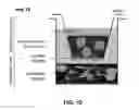 Fig. 03 - Method and apparatus for isolating invasive and metastatic cells for evaluating therapeutics and prediction of metastatic capacity