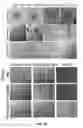 Fig. 05 - Method and apparatus for isolating invasive and metastatic cells for evaluating therapeutics and prediction of metastatic capacity