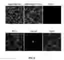 Fig. 10 - Method and apparatus for isolating invasive and metastatic cells for evaluating therapeutics and prediction of metastatic capacity