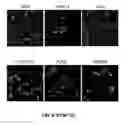 Fig. 11 - Method and apparatus for isolating invasive and metastatic cells for evaluating therapeutics and prediction of metastatic capacity
