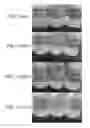 Fig. 12 - Method for preparing highly concentrated killed bacteria using membrane filter and killed bacteria prepared thereby