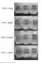 Fig. 13 - Method for preparing highly concentrated killed bacteria using membrane filter and killed bacteria prepared thereby