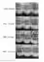 Fig. 14 - Method for preparing highly concentrated killed bacteria using membrane filter and killed bacteria prepared thereby
