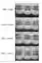Fig. 15 - Method for preparing highly concentrated killed bacteria using membrane filter and killed bacteria prepared thereby