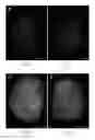 Fig. 03 - Methods of recellularizing a tissue or organ for improved transplantability