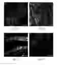 Fig. 04 - Methods of recellularizing a tissue or organ for improved transplantability