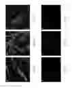 Fig. 07 - Methods of recellularizing a tissue or organ for improved transplantability