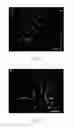 Fig. 10 - Methods of recellularizing a tissue or organ for improved transplantability