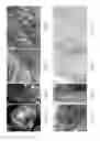 Fig. 12 - Methods of recellularizing a tissue or organ for improved transplantability