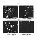 Fig. 11 - Method for inducing oligodendrocyte precursor cells from Oct4-induced human somatic cells through direct reprogramming