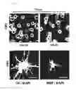 Fig. 13 - Method for inducing oligodendrocyte precursor cells from Oct4-induced human somatic cells through direct reprogramming