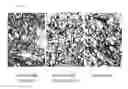 Fig. 15 - Method for inducing oligodendrocyte precursor cells from Oct4-induced human somatic cells through direct reprogramming