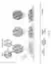 Fig. 02 - Encapsulation and cardiac differentiation of hiPSCs in 3D PEG-fibrinogen hydrogels