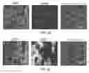 Fig. 10 - Encapsulation and cardiac differentiation of hiPSCs in 3D PEG-fibrinogen hydrogels