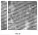 Fig. 12 - Encapsulation and cardiac differentiation of hiPSCs in 3D PEG-fibrinogen hydrogels