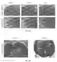 Fig. 16 - Encapsulation and cardiac differentiation of hiPSCs in 3D PEG-fibrinogen hydrogels