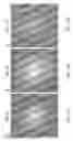 Fig. 19 - Encapsulation and cardiac differentiation of hiPSCs in 3D PEG-fibrinogen hydrogels