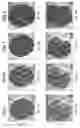 Fig. 21 - Encapsulation and cardiac differentiation of hiPSCs in 3D PEG-fibrinogen hydrogels