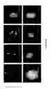 Fig. 22 - Encapsulated liver tissue